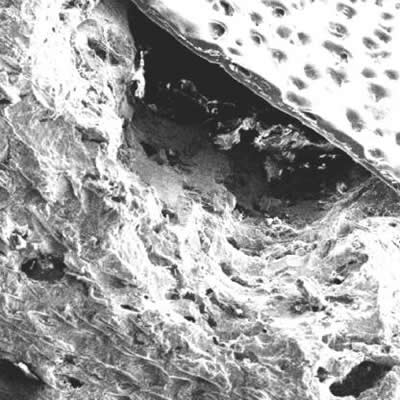 Mouse Chew SEM Image